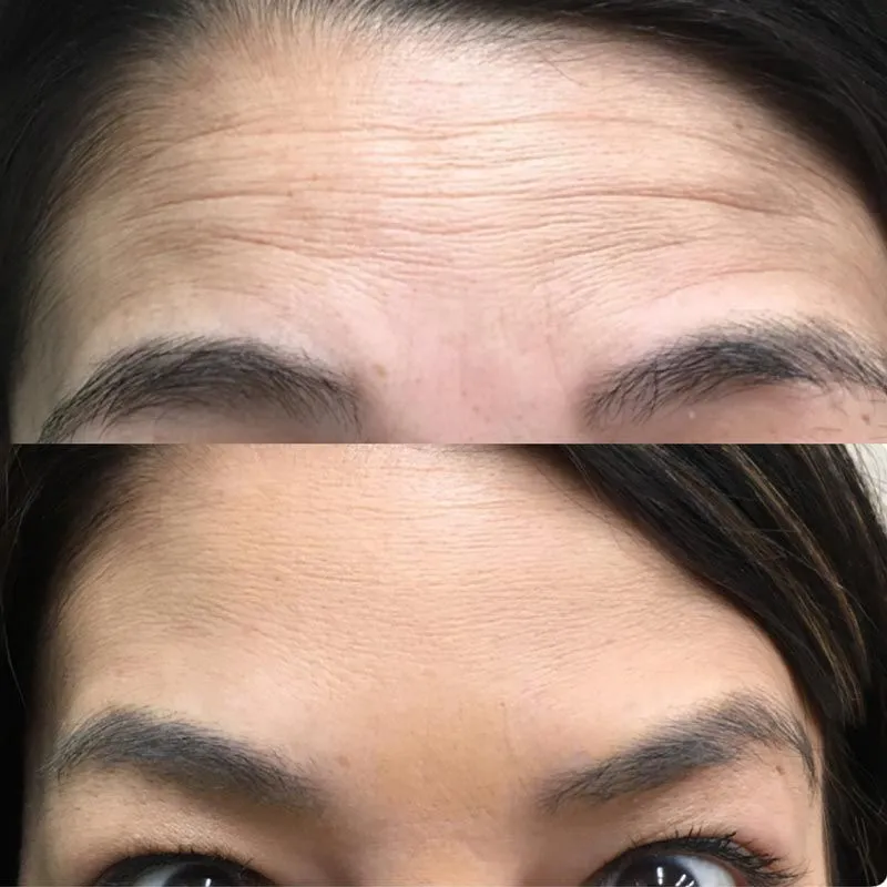 LA CROWN®️ DERMATOLOGY AESTHETIC CLINIC (Celebrity secrets) (Best in Jayanagar, Bangalore)