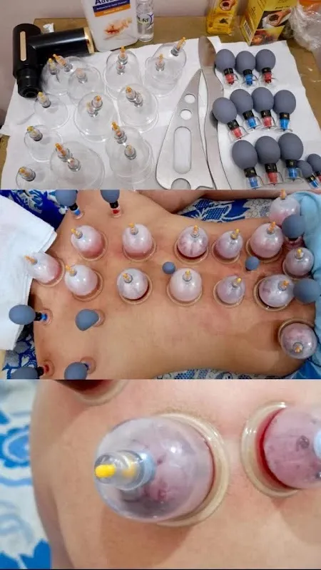 KABUL Massage SPA Hijama Therapy کابل ماساژ، مساج