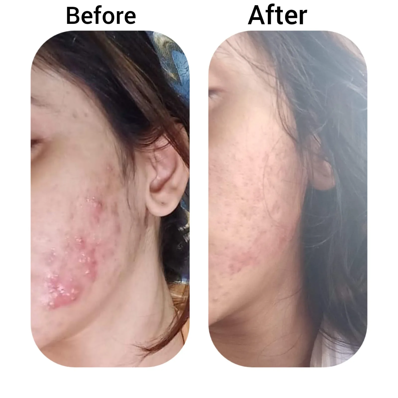 Lylac Beauty & Aesthetic Clinic