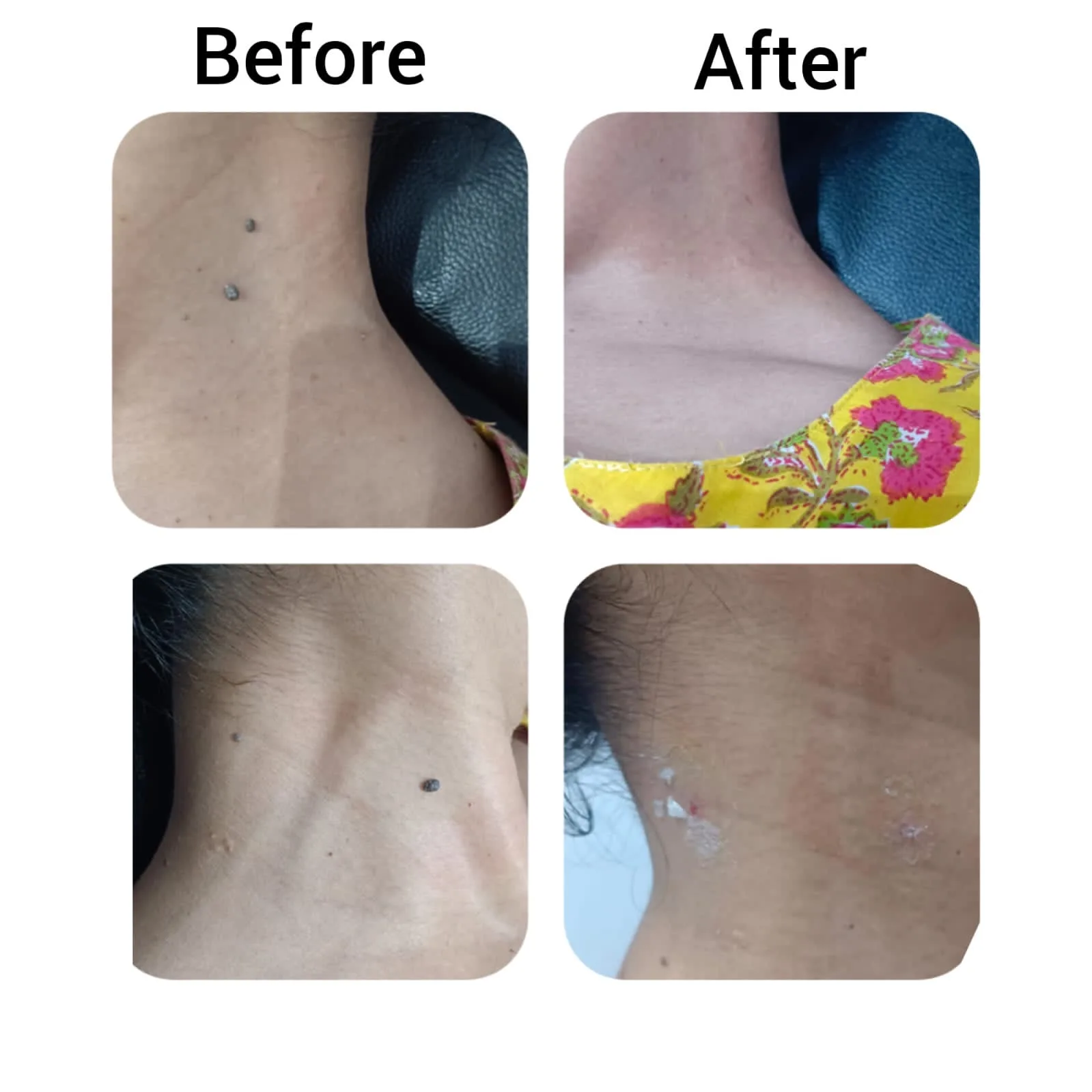 Lylac Beauty & Aesthetic Clinic