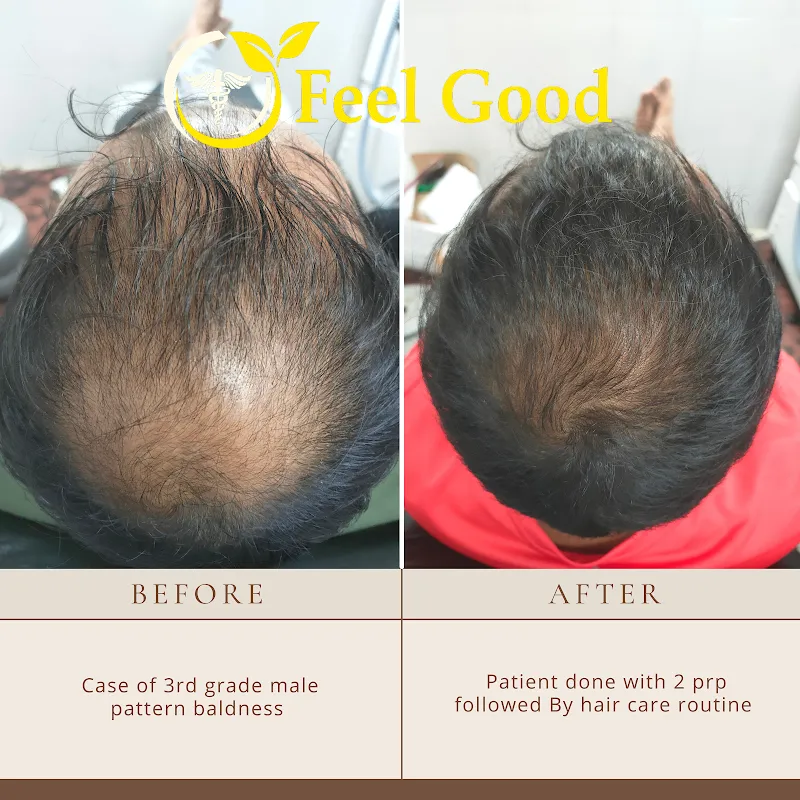 FEELGOOD SKIN & HAIR CLINIC – Dr. Arbaz & Dr. Fauzia Pathan