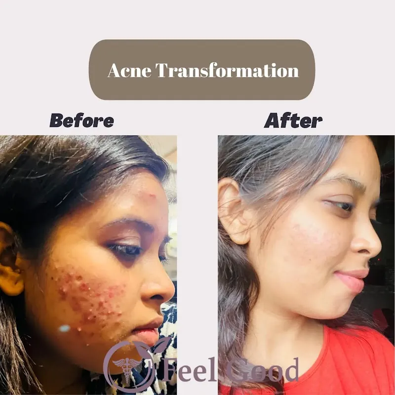 FEELGOOD SKIN & HAIR CLINIC – Dr. Arbaz & Dr. Fauzia Pathan