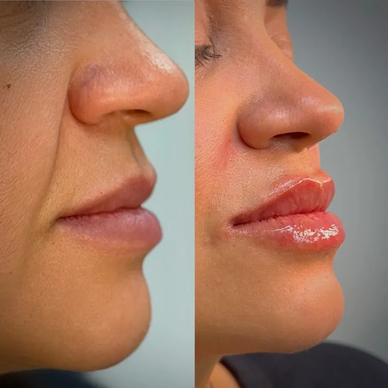 Lumen Beauty & Wellness