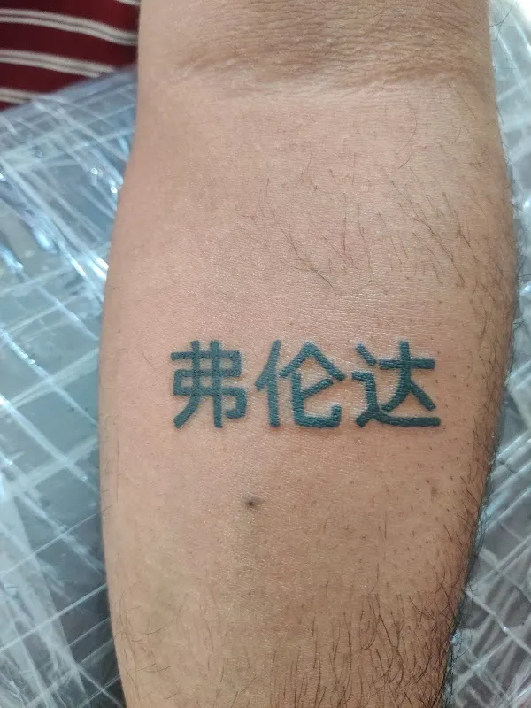 Gk tattoo removing studio