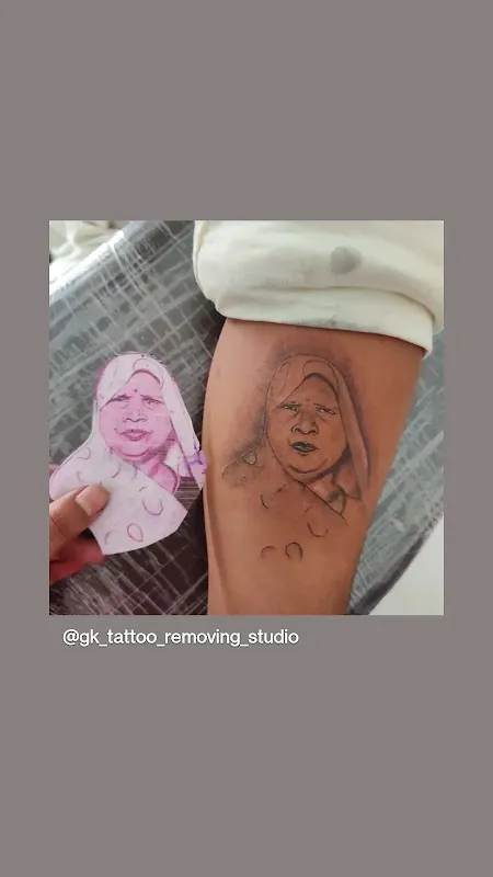 Gk tattoo removing studio