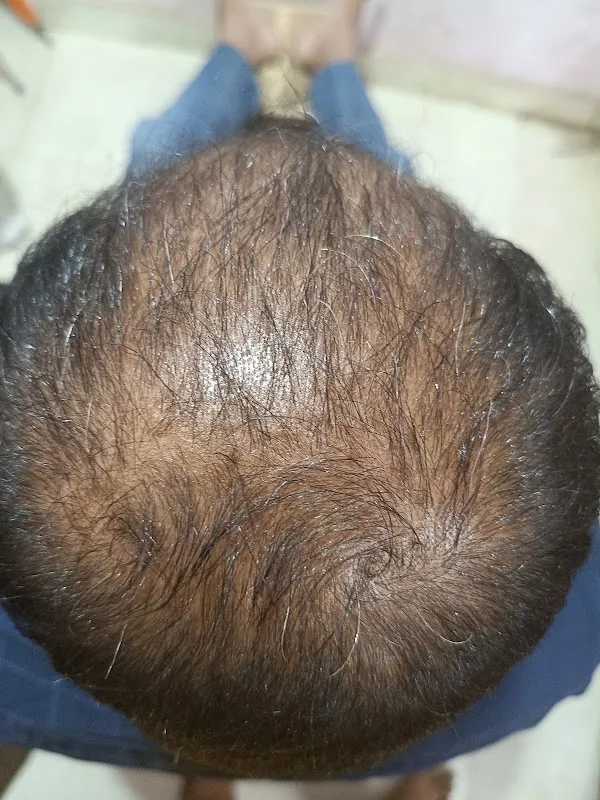 Sanjeevani Ayurved Kansya Thali Massage Kendra
