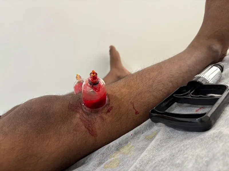 Life Cure Hijama Center (Cupping Therapy Center)