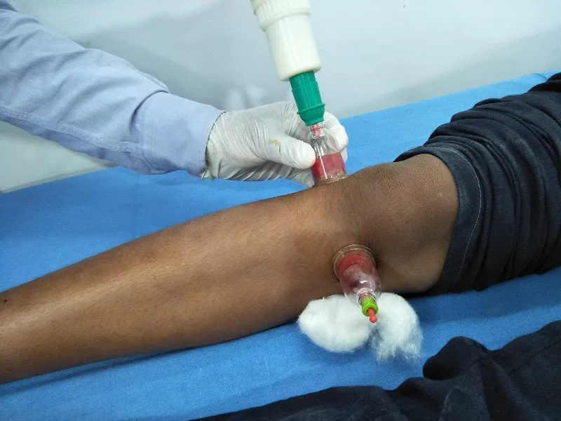 Life Cure Hijama Center (Cupping Therapy Center)