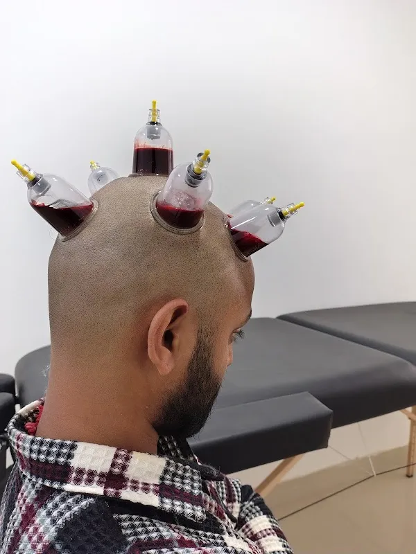 Life Cure Hijama Center (Cupping Therapy Center)