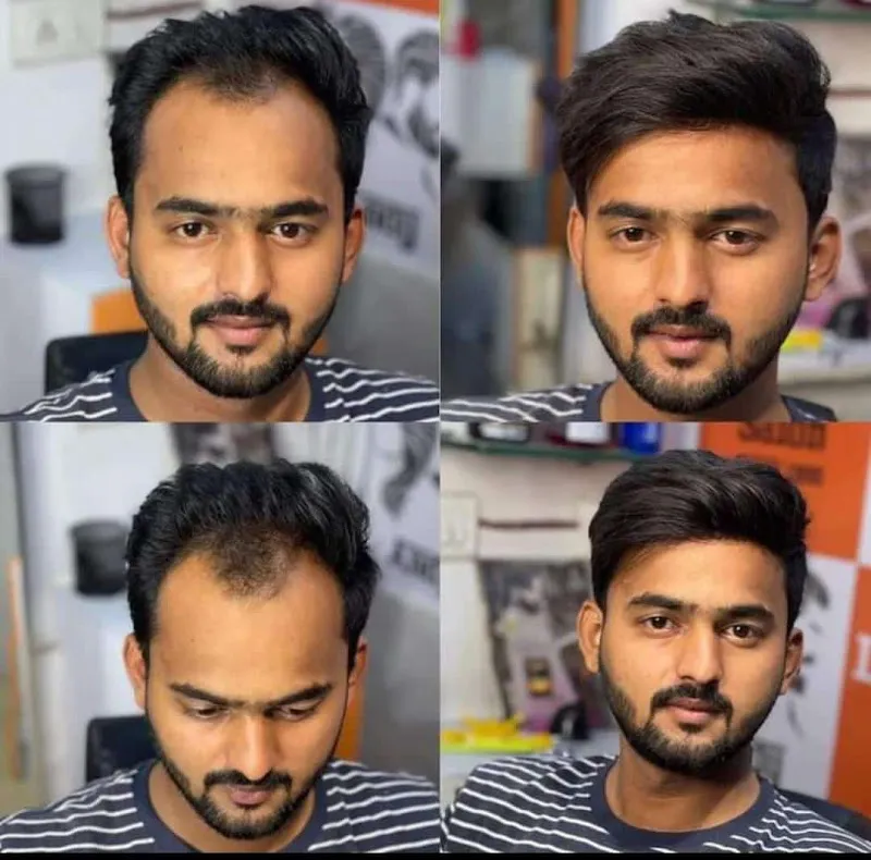 Stylo Unisex Salon & Hair Patch wig Center Akola