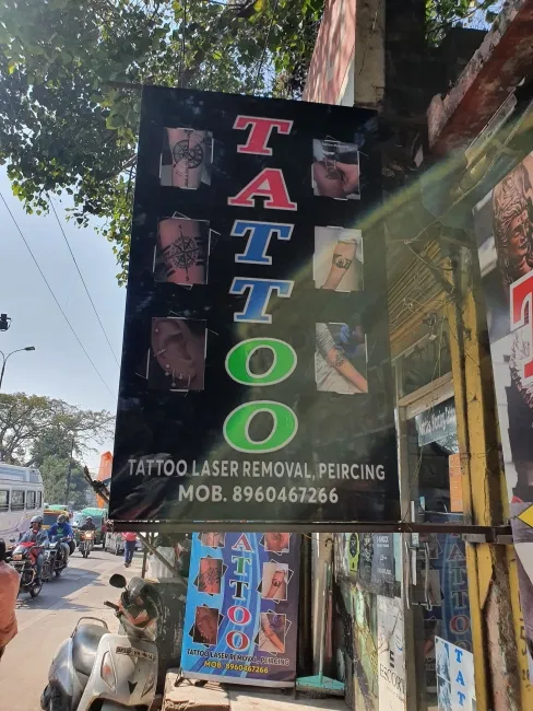 Tattoo Laser Removal