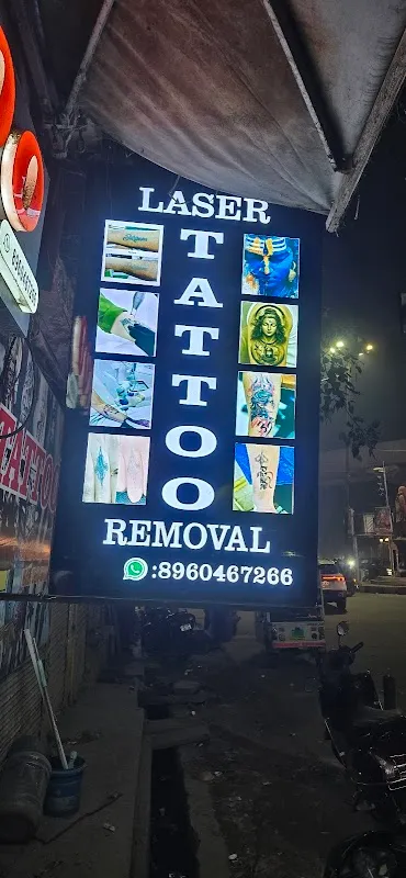 Tattoo Laser Removal