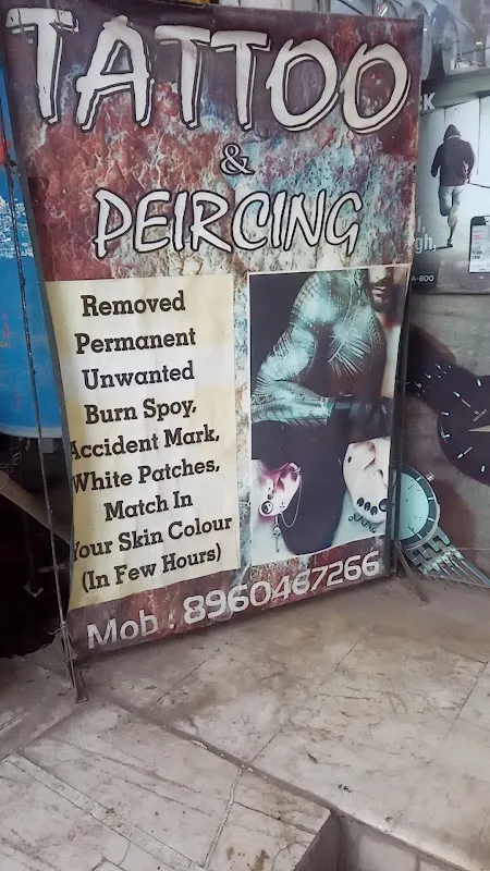 Tattoo Laser Removal