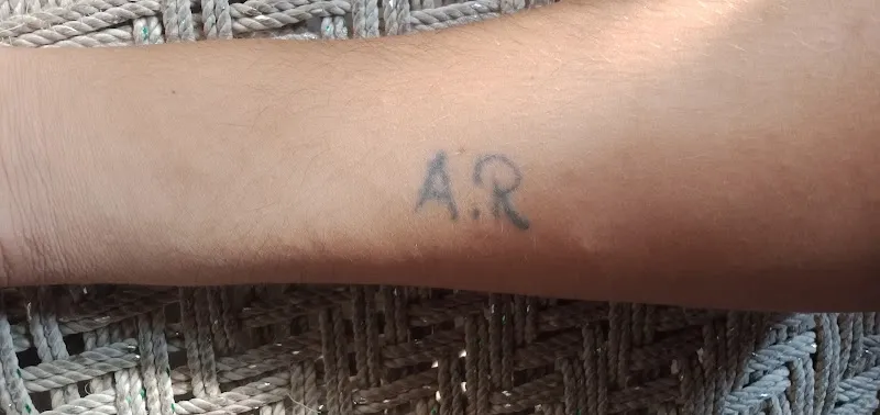Tattoo Laser Removal