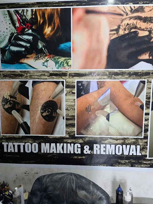 Tattoo Laser Removal