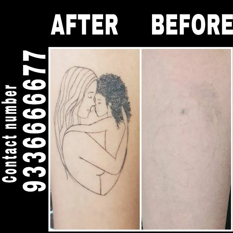 Menders Tattoo Removal & piercing lucknow