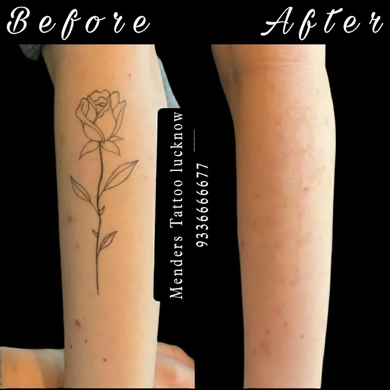 Menders Tattoo Removal & piercing lucknow