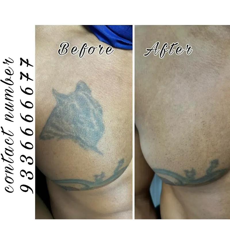 Menders Tattoo Removal & piercing lucknow