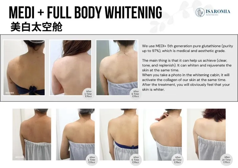 Isaromia Aesthetics JB - Facial, Whitening, Slimming Treatment