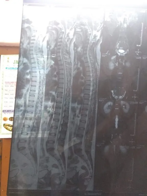 Dr. Reddy's Sadhana Nature Cure Yoga & Back Pain Clinic