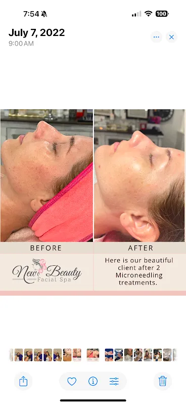 Newbeauty Facial Spa