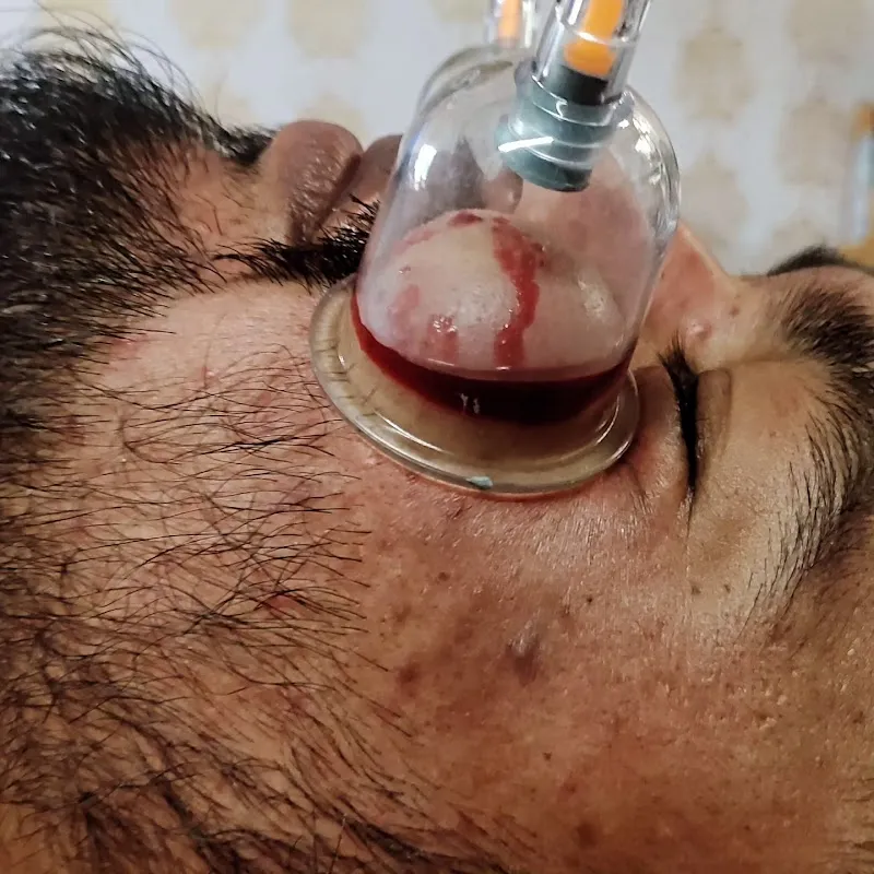 Relax Health Care Hijama Treatment centre