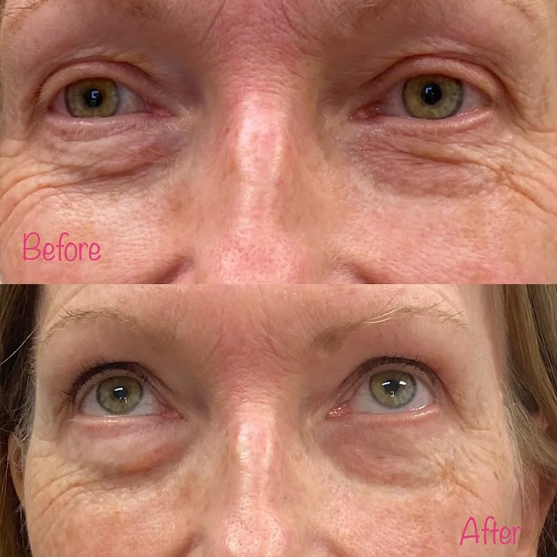 Ageless U Med Spa