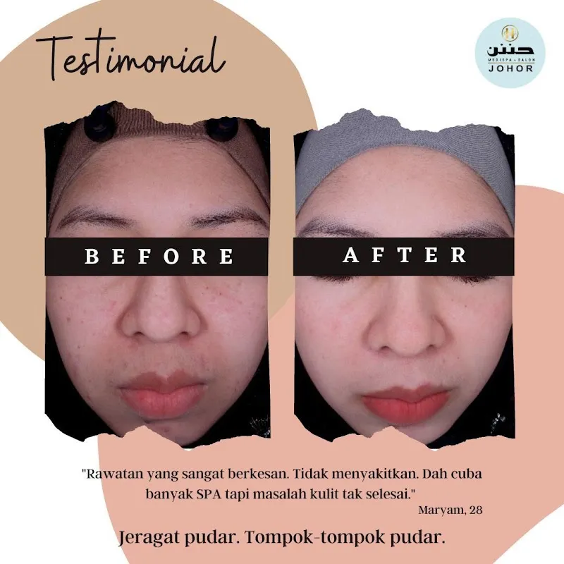 Spa Kulai