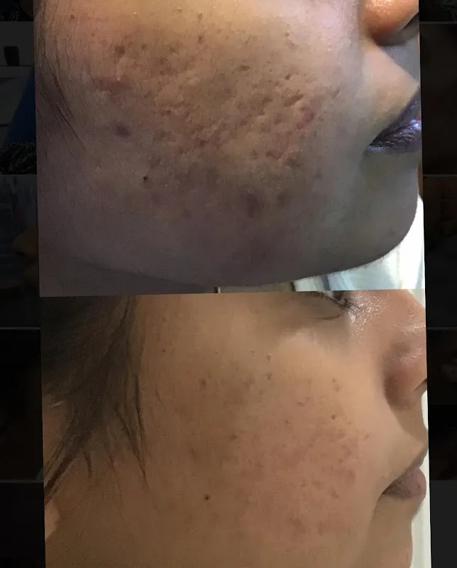 Dr.Gupta's Skin Hair and Laser Clinic