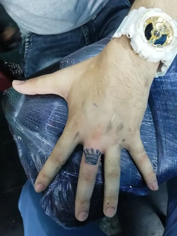 JackTattoostudio $tattoo removel