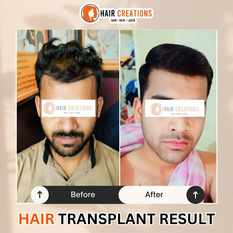 Hair Creations Bhubaneswar