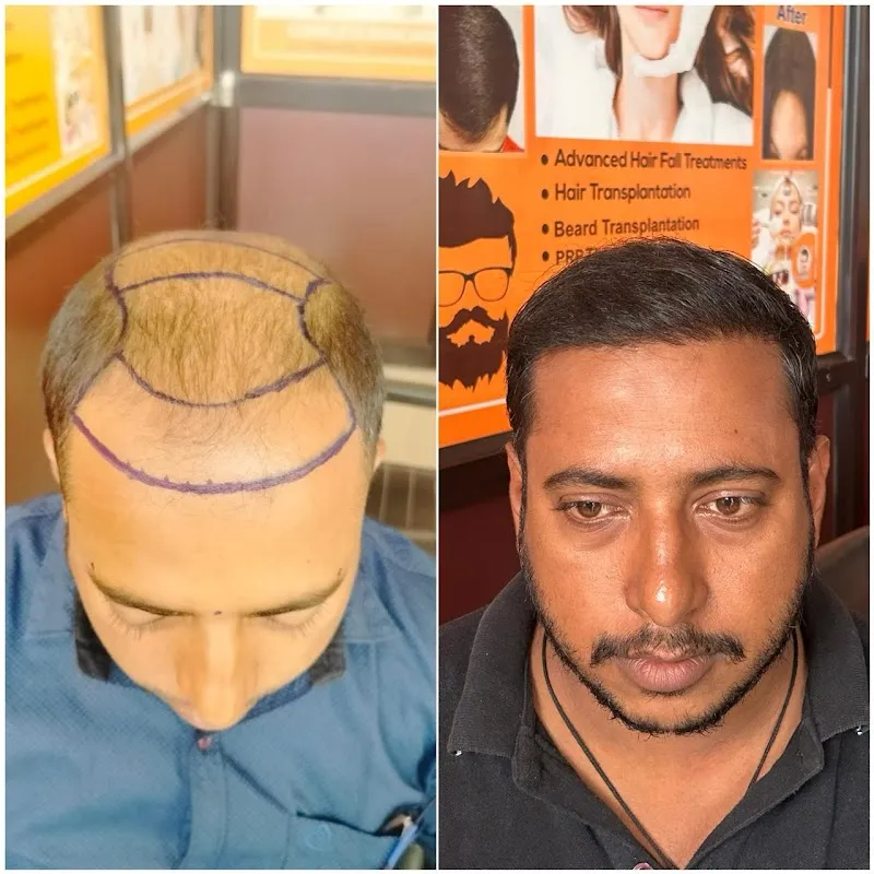 Hair Creations Bhubaneswar
