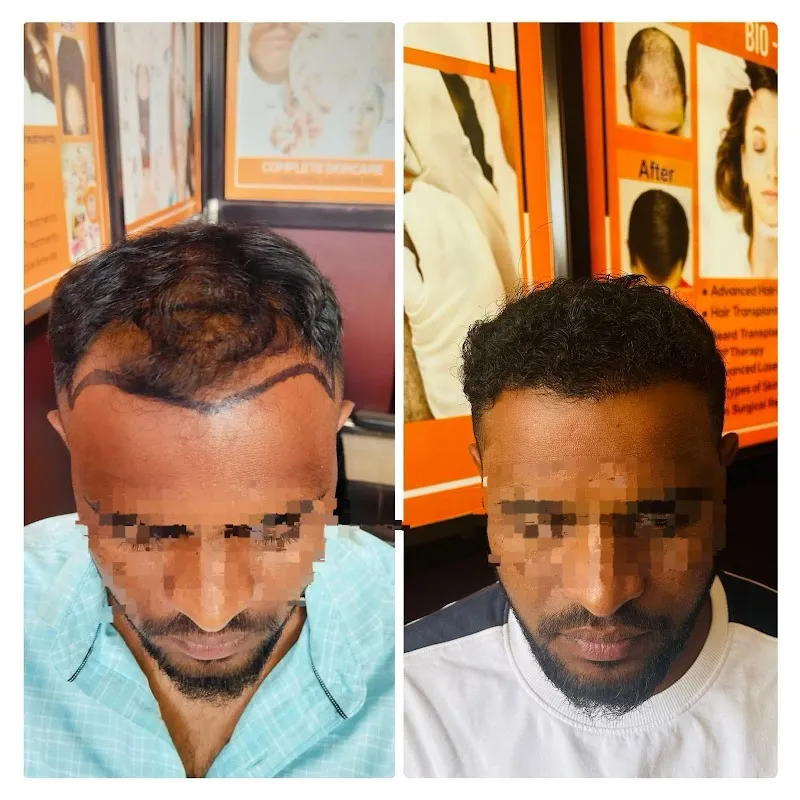 Hair Creations Bhubaneswar