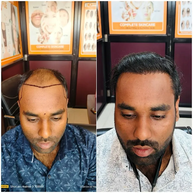Hair Creations Bhubaneswar