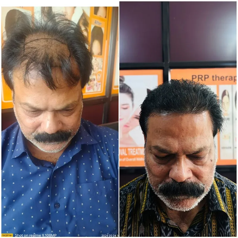 Hair Creations Bhubaneswar